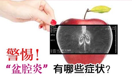盆腔炎症状有哪些